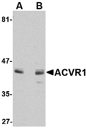 Western blot analysis of ACVR1 in A549 cell lysate with ACVR1 antibody at (A) 1 and (B) 2 μg/mL