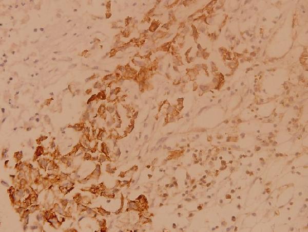 a00799 csk primary antiboties ihc testing 2