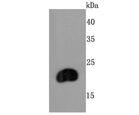 Western blot analysis of FGF21 on rat liver cells lysates using anti-FGF21 antibody at 1/1,000 dilution