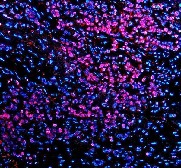 a00803 3 tbx5 primary antibodies if testing 1