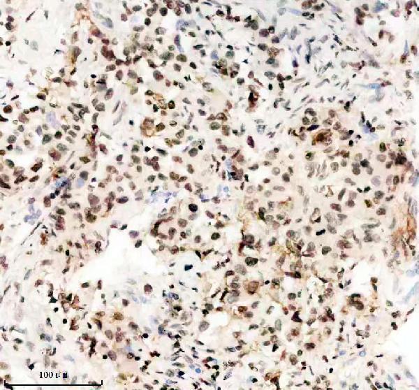IHC analysis of TBX5 using anti-TBX5 antibody (A00803-3)