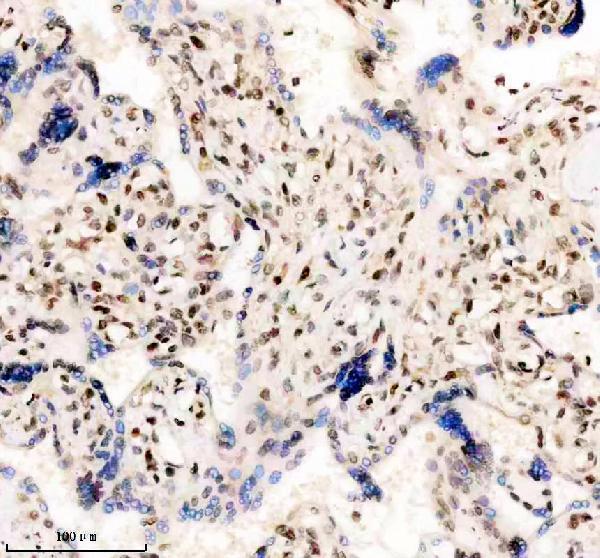IHC analysis of TBX5 using anti-TBX5 antibody (A00803-3)