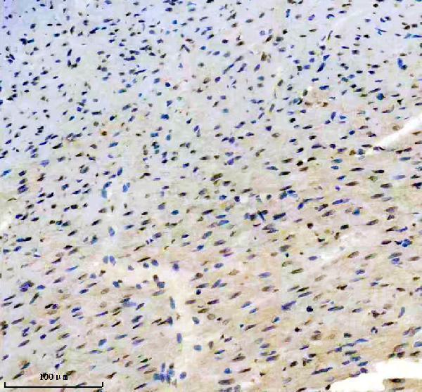 a00803 3 tbx5 primary antibodies ihc testing 4