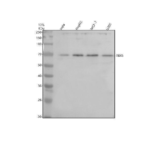 Western blot analysis of TBX5 using anti-TBX5 antibody (A00803-3)