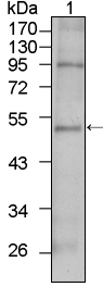 a00803 tbx5 primary antibodies wb testing 1