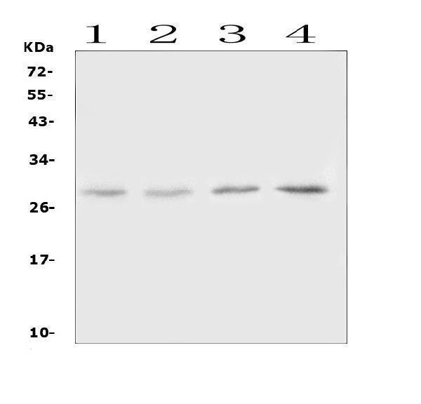  Western blot analysis of Oncostatin M  using anti-Oncostatin M  antibody (A00804-1)