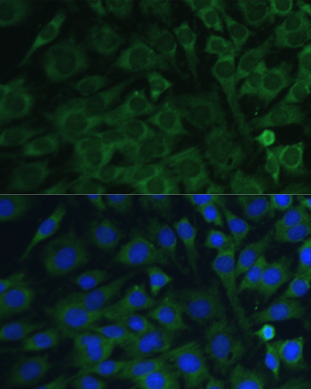 Immunofluorescence analysis of C6 cells using Oncostatin M antibody  at dilution of 1:100