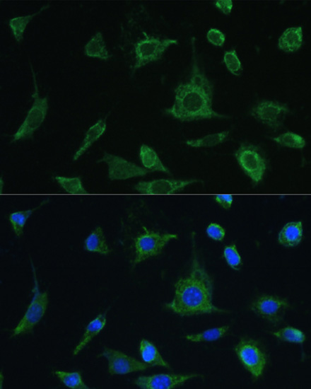 Immunofluorescence analysis of L-929 cells using Oncostatin M antibody  at dilution of 1:100