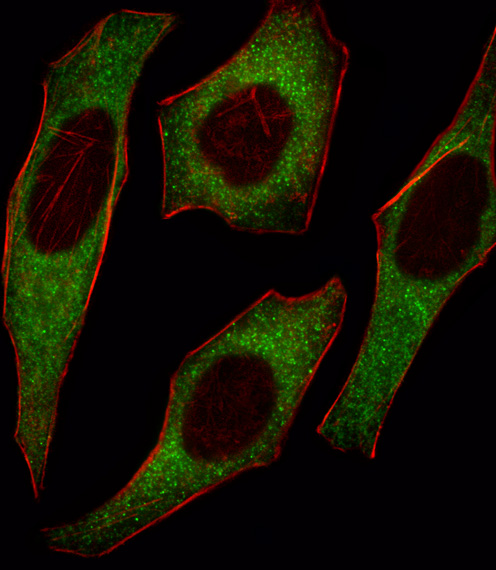 a00805 1 anti irs2 antibody c term if testing 1