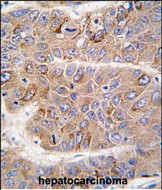 a00805 1 anti irs2 antibody c term ihc p testing 4