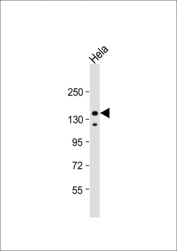a00805 1 anti irs2 antibody c term wb testing 2
