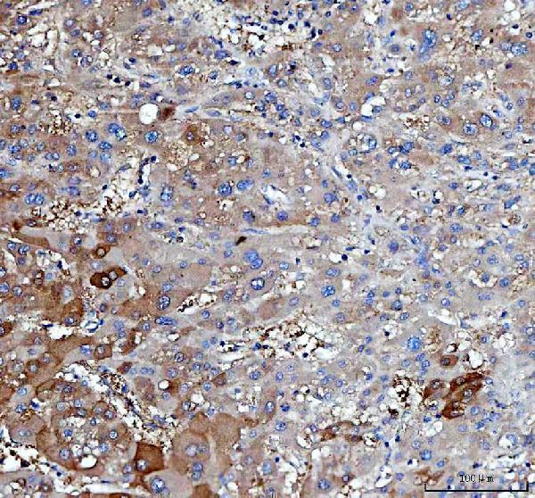  IHC analysis of IRS2 using anti-IRS2 antibody (A00805-3)