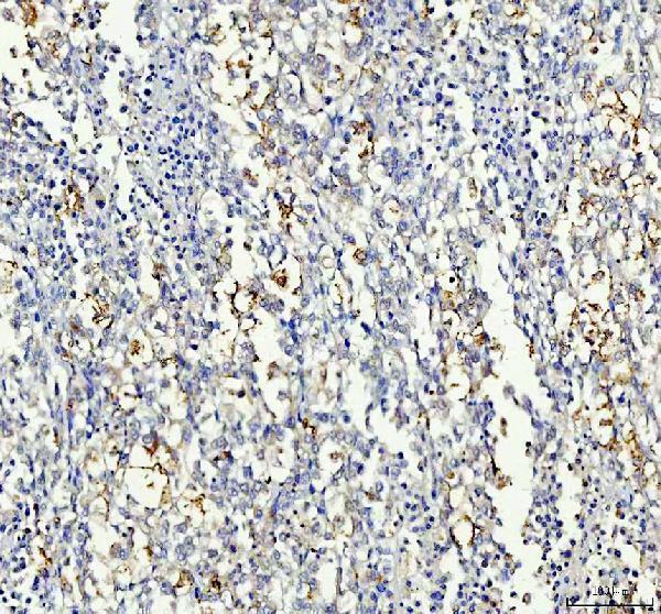  IHC analysis of IRS2 using anti-IRS2 antibody (A00805-3)