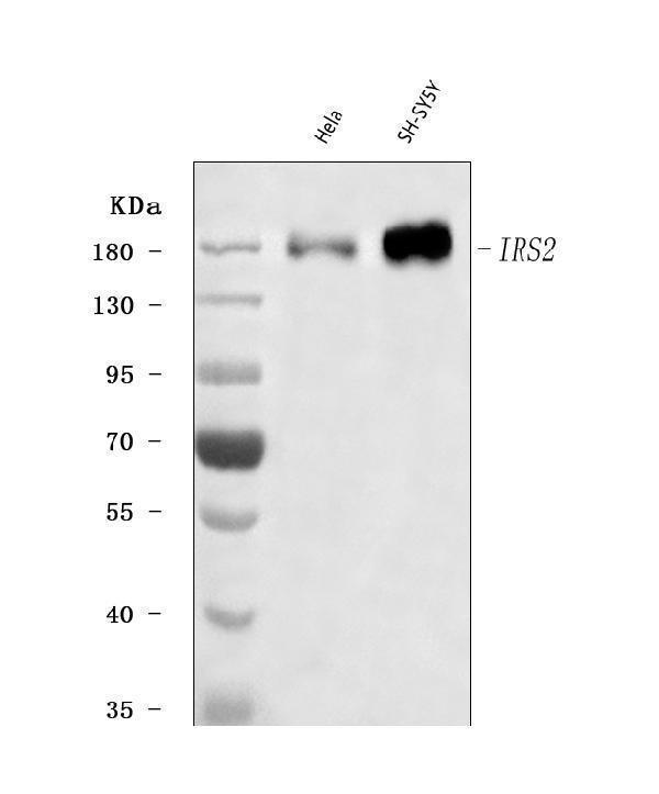  Western blot analysis of IRS2 using anti-IRS2 antibody (A00805-3)