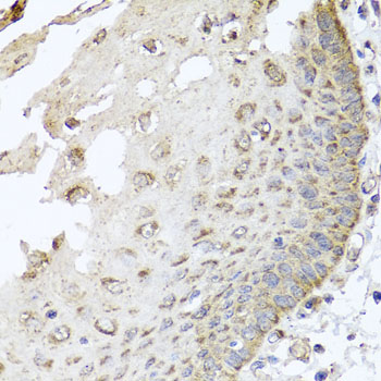 a00805 irs2 primary antiboties if testing 2