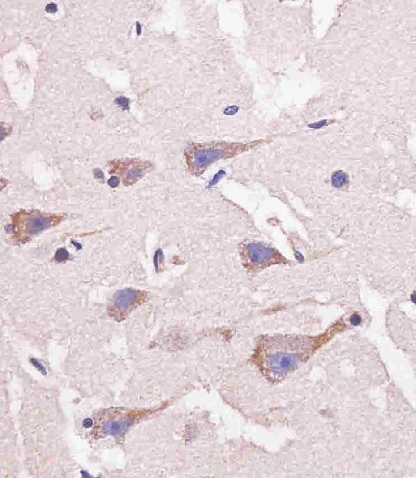 a00806 1 anti nestin antibody s1409 ihc p testing 6