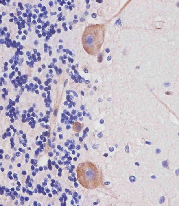 a00806 1 anti nestin antibody s1409 ihc p testing 7