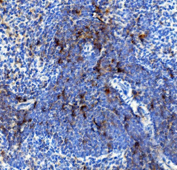 a00807 2 il4r primary antibodies ihc testing 1