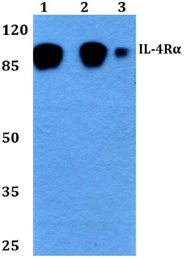a00807 il4r primary antiboties wb testing 1