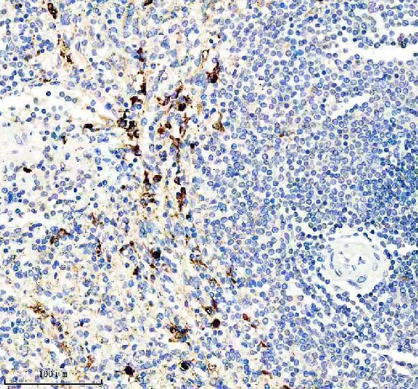  IHC analysis of IL21R using anti-IL21R antibody (A00808-1)