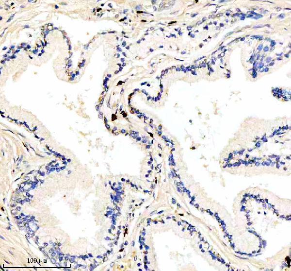  IHC analysis of IL21R using anti-IL21R antibody (A00808-1)