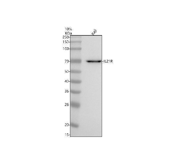  Western blot analysis of IL21R using anti-IL21R antibody (A00808-1)