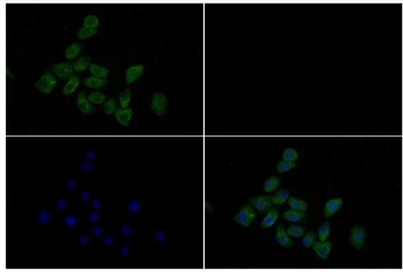 a00811 1 ptgs1 primary antiboties if testing 3