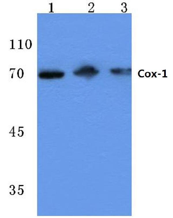 Western blot (WB) analysis of PTGS1 (S585) polyclonal antibody at 1:1000 dilution
Lane1:CT-26 whole cell lysate(20ug)
Lane2:SGC7901 whole cell lysate(20ug)