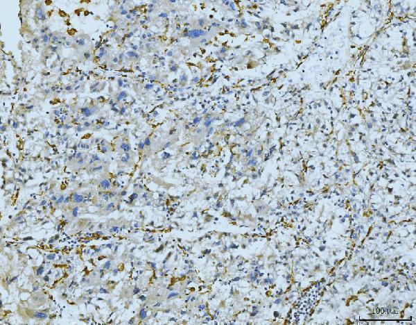  IHC analysis of CD163 using anti-CD163 antibody (A00812-1)