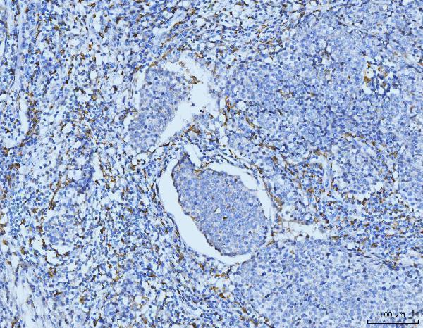 a00812 1 cd163 primary antibodies ihc testing 4
