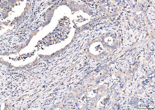 a00812 1 cd163 primary antibodies ihc testing 7
