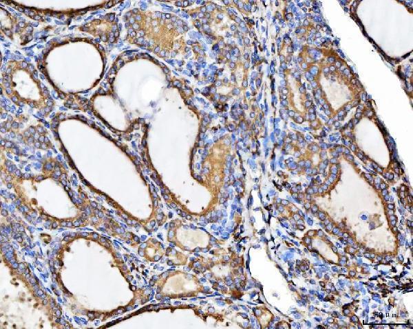 a00814 2 chm primary antibodies ihc testing 3