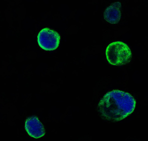 a00815 musk primary antibodies if testing 1