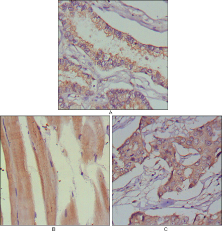 a00815 musk primary antibodies ihc testing 2