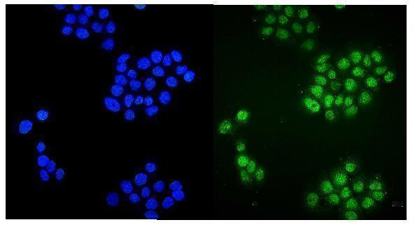 a00817 1 zbtb16 primary antibodies if testing 2