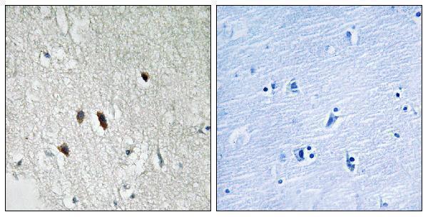 Immunohistochemistry analysis of paraffin-embedded human brain tissue, using RIPK2 Antibody