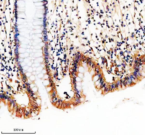 IHC analysis of RIPK2 using anti- RIPK2 antibody (A00818-2)