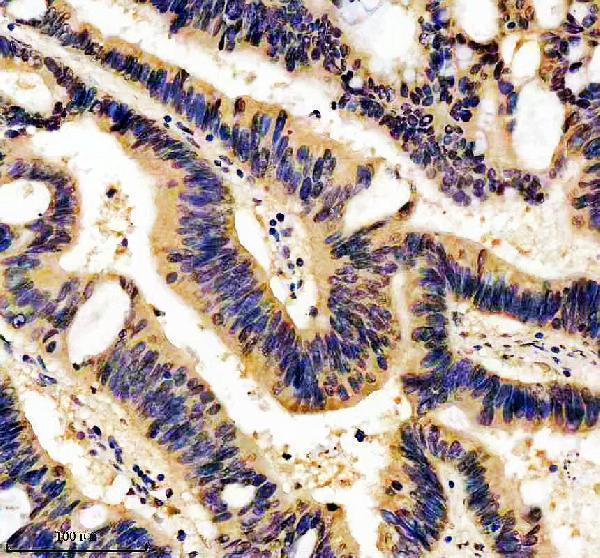 a00818 2 ripk2 primary antibodies ihc testing 2