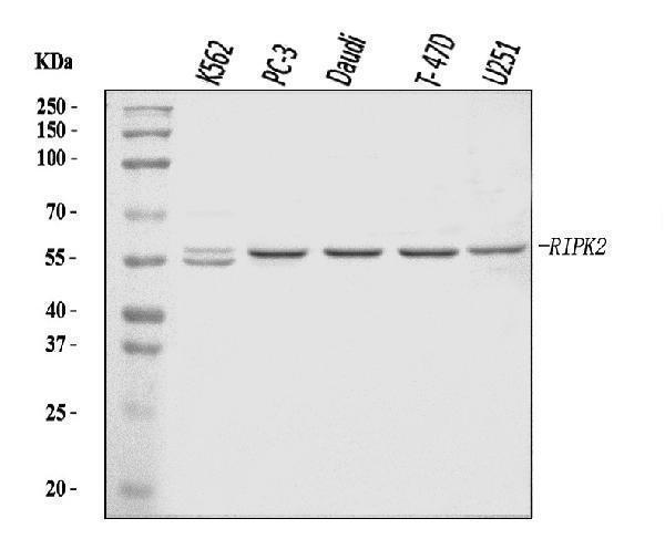  Western blot analysis of RIP2/RIPK2 using anti-RIP2/RIPK2 antibody (A00818-2)