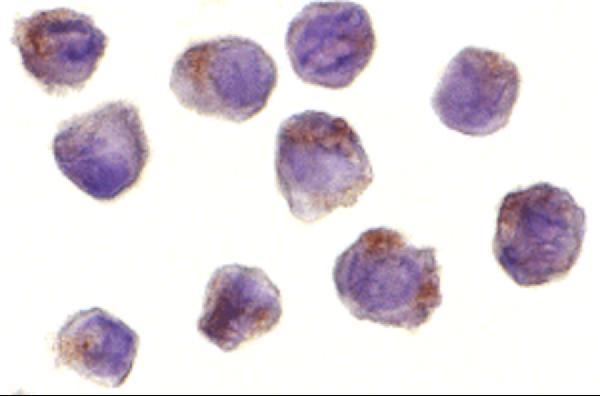 a00818 ripk2 primary antibodies icc testing 2