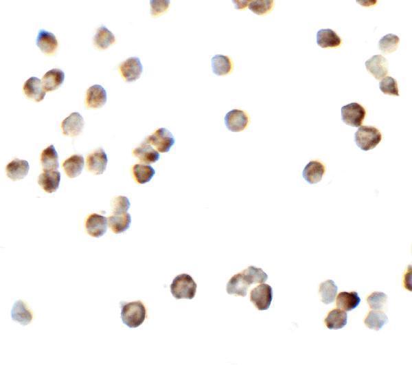 a00818 ripk2 primary antibodies icc testing 5