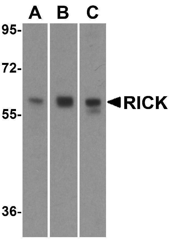 a00818 ripk2 primary antibodies wb testing 1