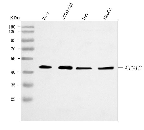  Western blot analysis of ATG12 using anti-ATG12 antibody (A00820-2)
