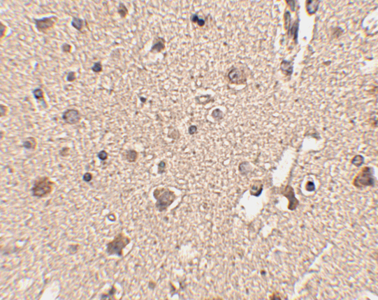 Immunohistochemistry of ATG12 in human brain tissue with ATG12 antibody at 2