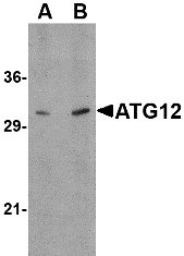 Western blot analysis of ATG12 in human brain tissue lysate with ATG12 antibody at (A) 0