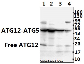 Western blot (WB) analysis of ATG12 (S129) polyclonal antibody at 1:500 dilution
Lane1:C6 whole cell lysate(40ug)
Lane2:CT26 whole cell lysate(40ug)
Lane3:HepG2 whole cell lysate(40ug)
Lane4:HCT116 whole cell lysate(40ug)