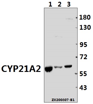 a00821 cyp21a2 primary antiboties wb testing 1