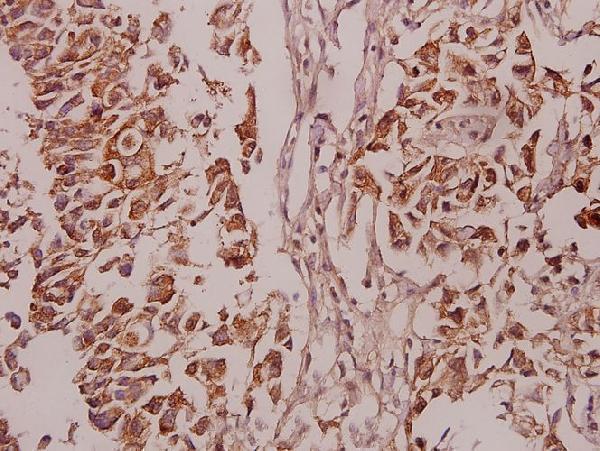 a00822s645 prkcd primary antiboties ihc testing 2