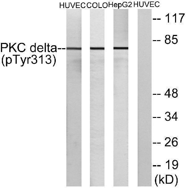 Western blot analysis of lysates from HepG2 cells, COLO205 cells and HUVEC cells, using PKC delta (Phospho-Tyr313) Antibody
