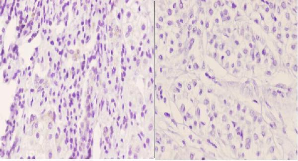 a00822y52 prkcd primary antiboties ihc testing 2